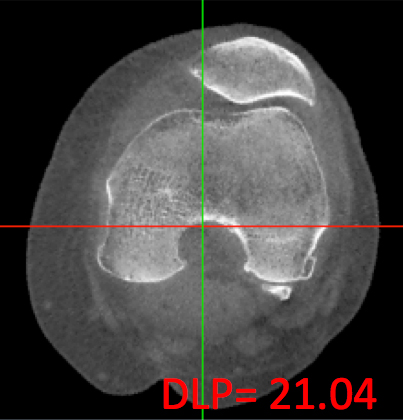 cbct-axial-knee