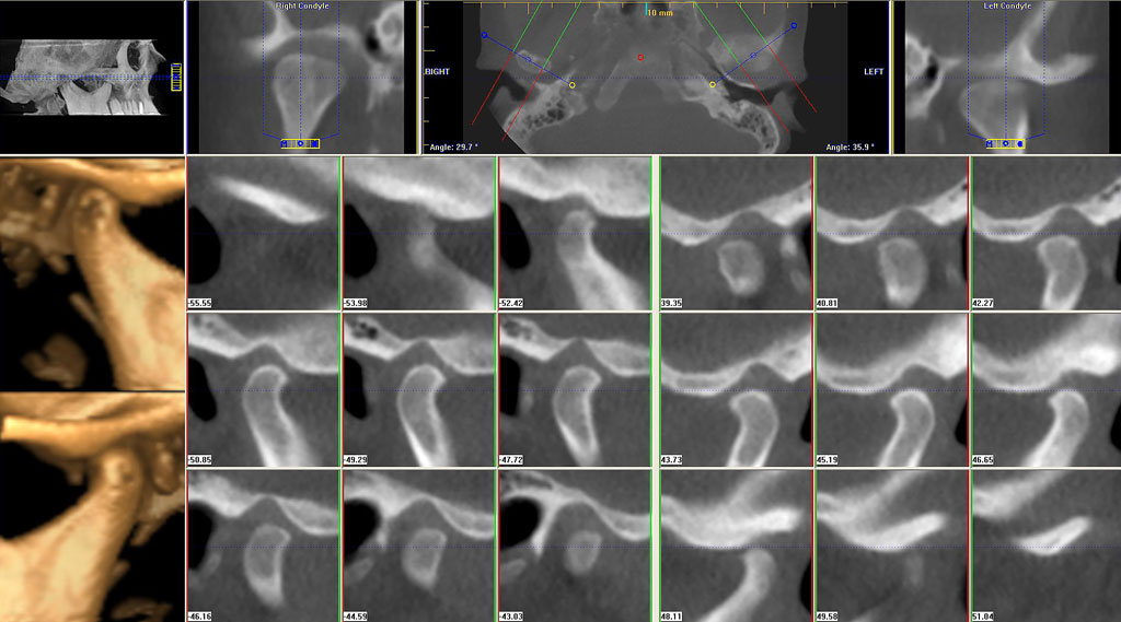 tmj cbct scan Cavendish Imaging
