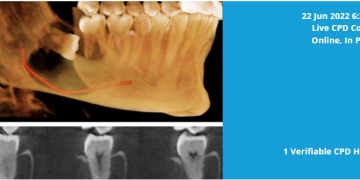 Learn How to Identify Abnormalities on CBCT