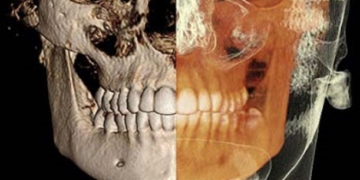 Your Office May Need Level 1 & Level 2 Training in Dental CBCT