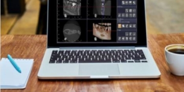 Mastering the Art of Crafting a Comprehensive Report for a Cone Beam CT Scan.